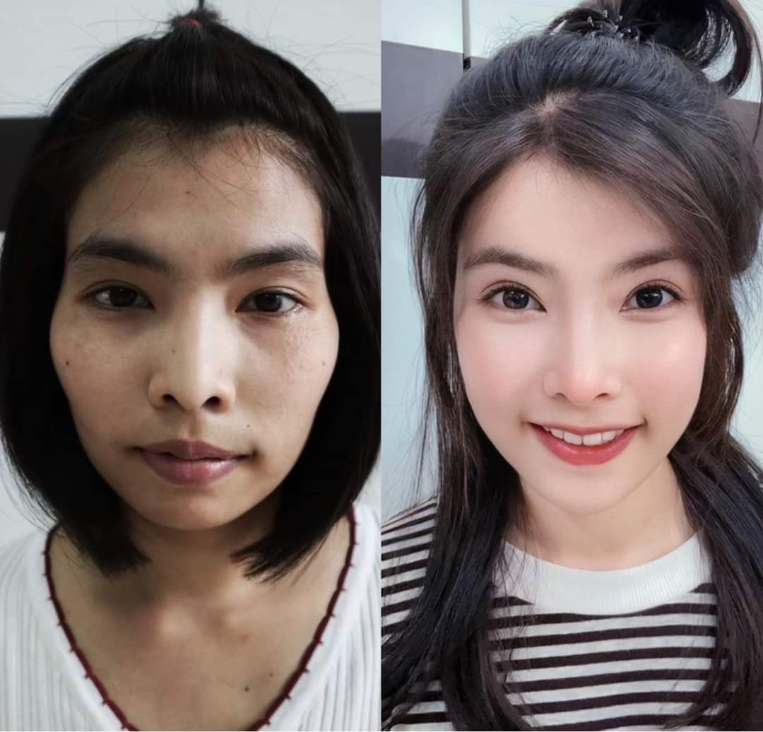 Facelift — Before & After 1 · The Valley, Kuala Lumpur
